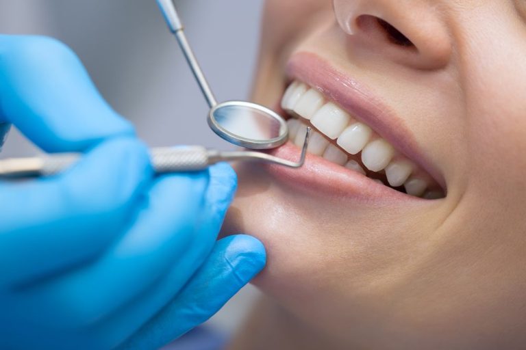 Smart Savings Strategies for Dental Visits